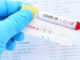 COVID 19 PCR Testing